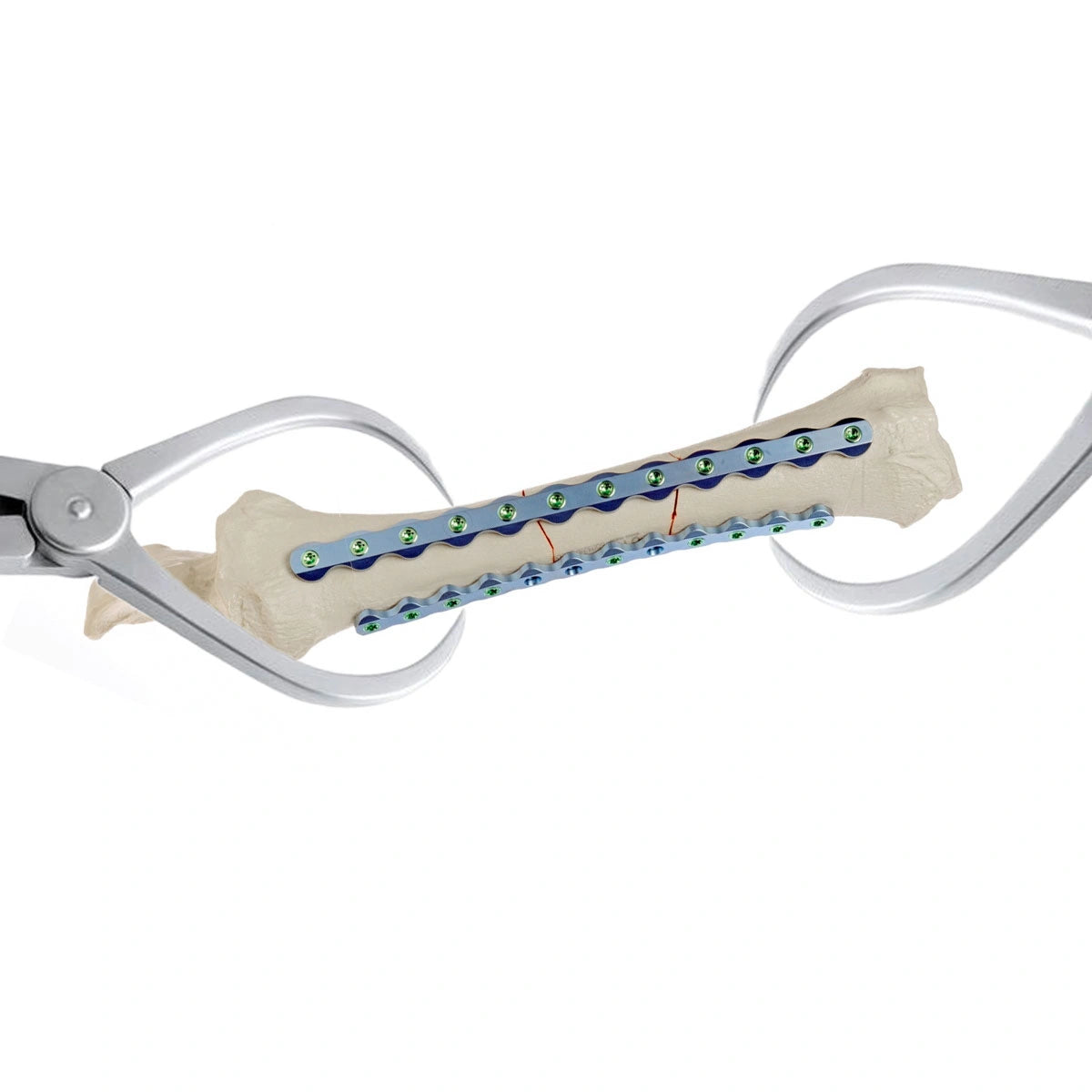 Veterinary Reduction Forceps (Pointed Tip) for Precise Small Animal Orthopedic Surgery