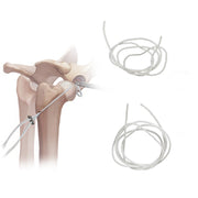Veterinary Suture System Nylon Filament for Use with Button Suture Anchors