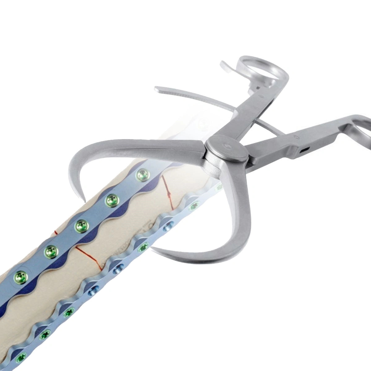 Veterinary Reduction Forceps (Pointed Tip) for Precise Small Animal Orthopedic Surgery