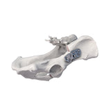3.5mm Titanium AO-Compatible DPO Locking Plate for Double Pelvic Osteotomy in Medium & Large Dogs - xcvet.com