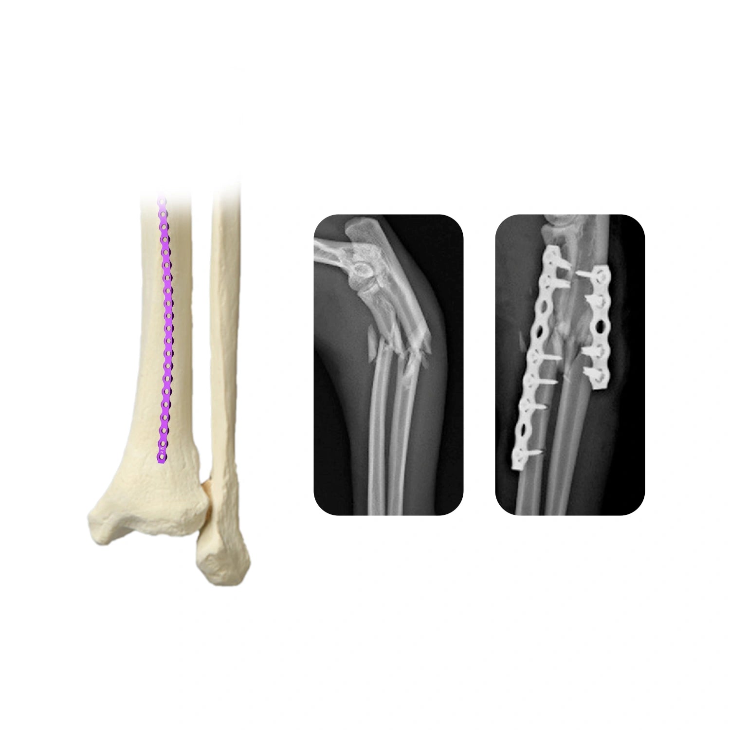 Veterinary 3.2mm ALPS Titanium Alloy Locking Plate with 22, 23, or 26 Holes - xcvet.com