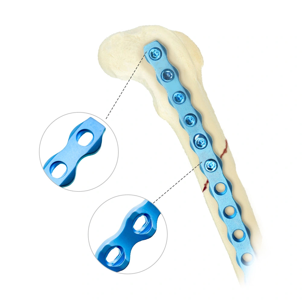 Best Sale Veterinary Orthopedic Surgery Bone Implants 2.4mm ALPS-II Locking Plate