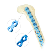 Best Sale Veterinary Orthopedic Surgery Bone Implants 2.4mm ALPS-II Locking Plate