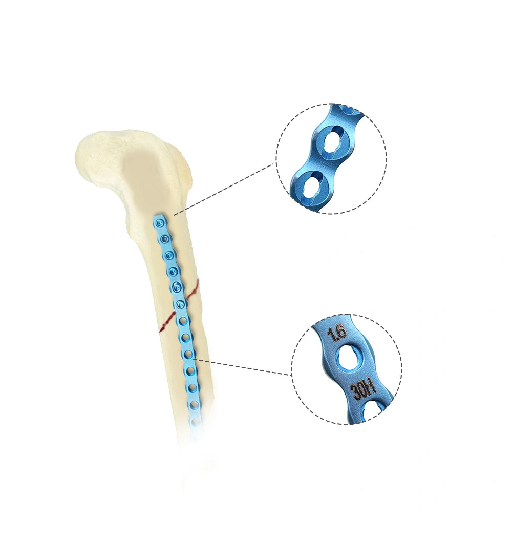 Veterinary Orthopedics ALPS-II 1.6mm Reliable Fracture Plate System - xcvet.com