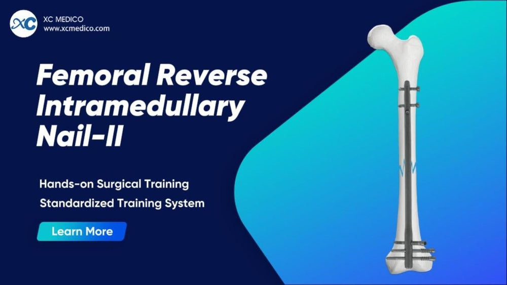 Surgical Technique: Femoral Reverse Nail Instrument Set Operation Guide | XC Medico