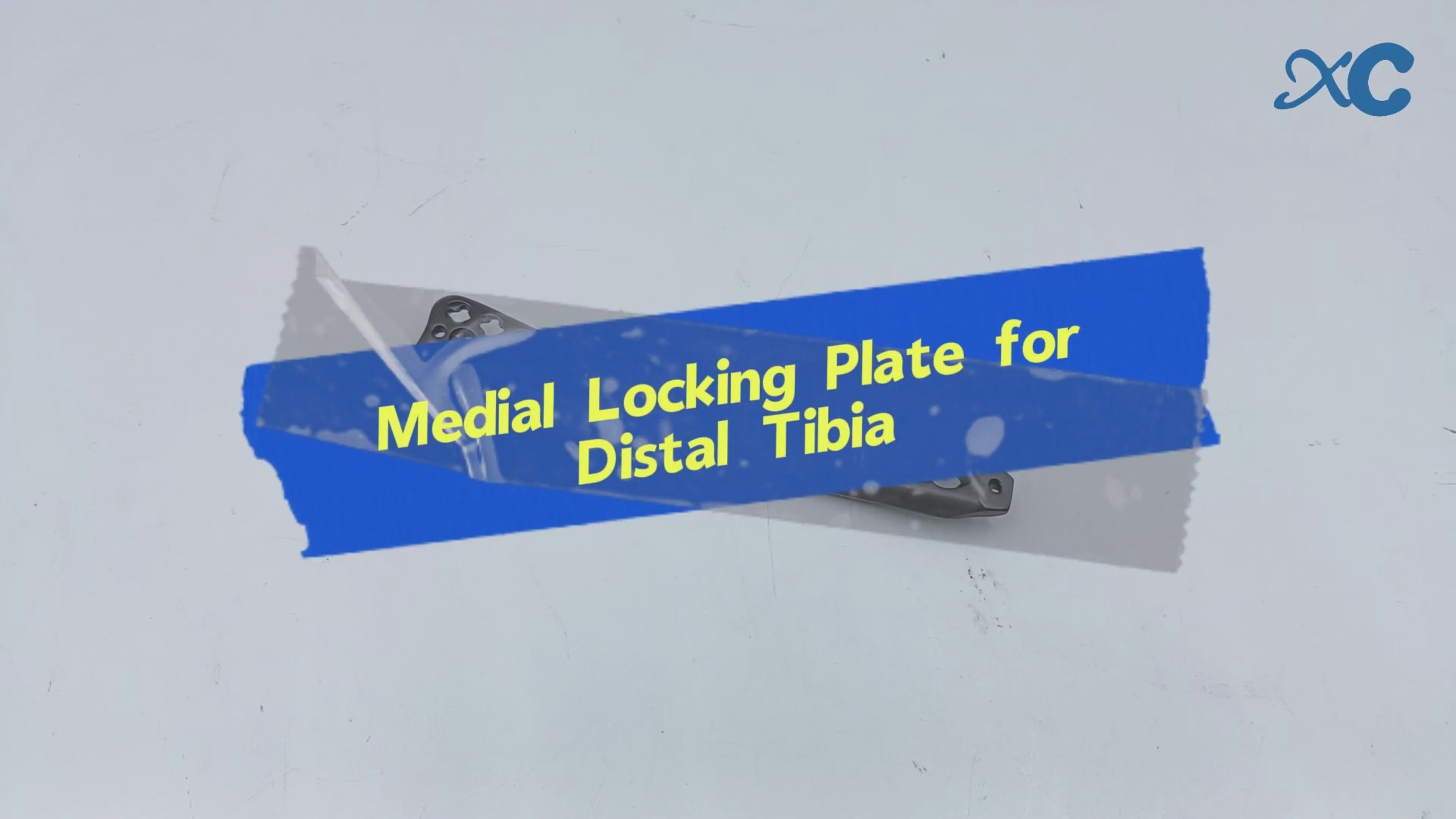 Load video: Medial Polyaxial Plate for Distal Tibia