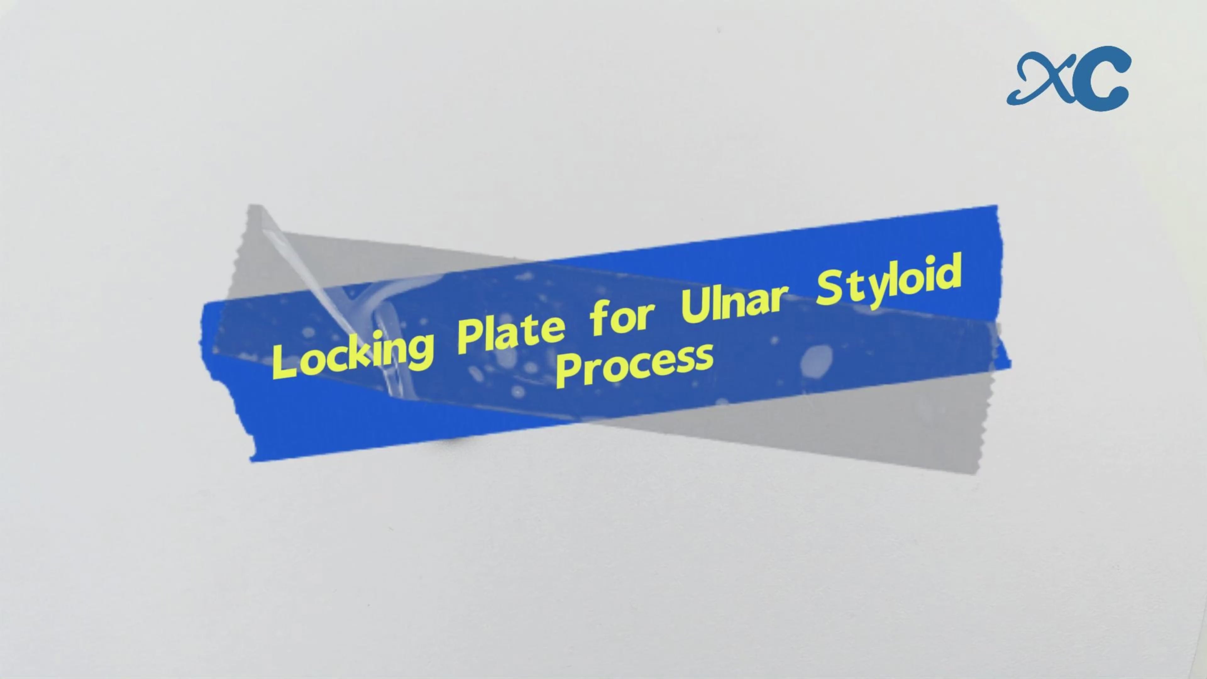 Load video: Locking Plate for Ulnar Styloid ProcessⅡ