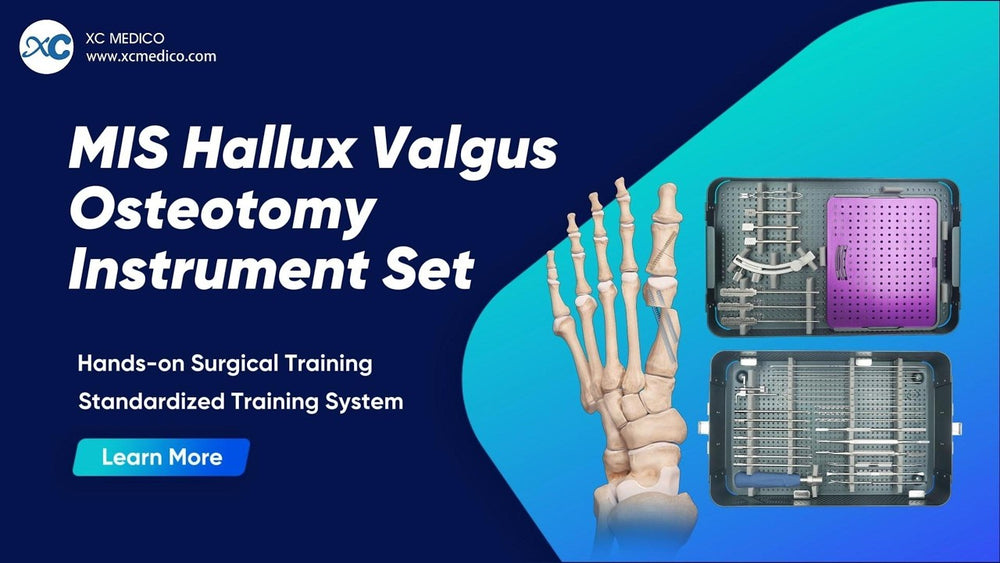 Surgical Technique: MIS Hallux Valgus Osteotomy System | XC Medico