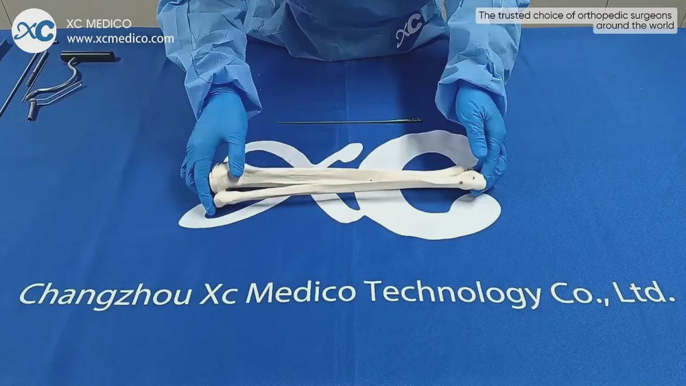 XC Medico Fibular Intramedullary Nail System | Advanced Orthopedic Solutions