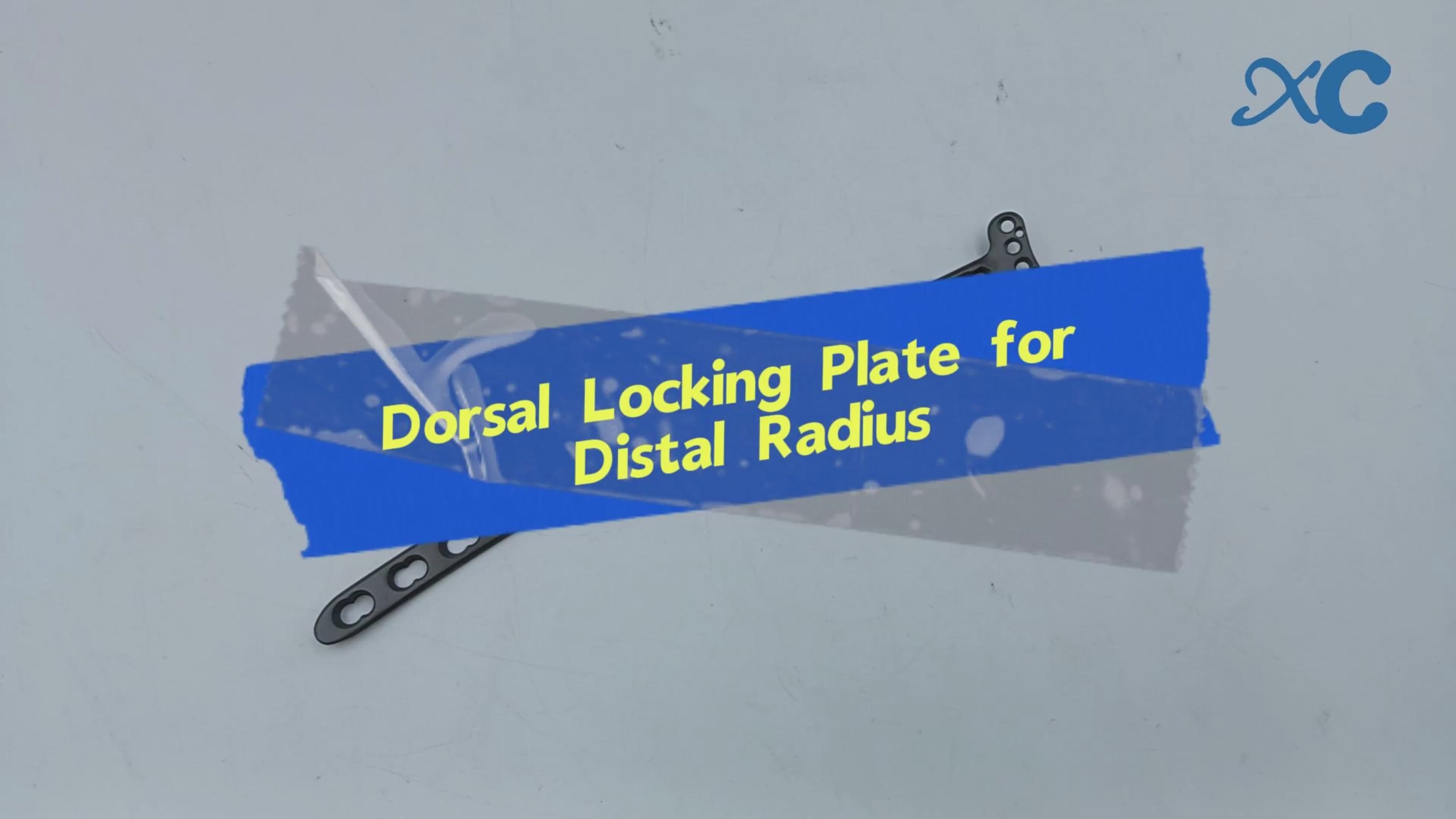 Load video: Dorsal Locking Plate for Distal Radius