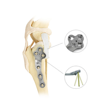 2.0mm Veterinary Titanium Multi-Axial Locking TPLO Plate for Tibial Fixation - xcvet.com